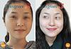 Click image for larger version. 

Name:	hinh-anh-tri-tan-nhang-11.jpg 
Views:	69 
Size:	50.4 KB 
ID:	138